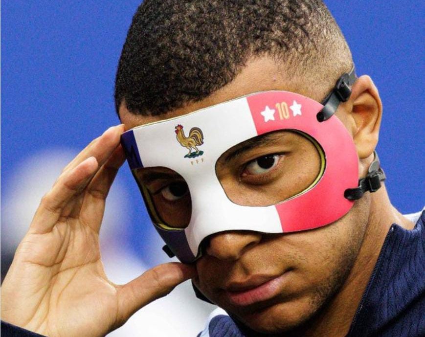 Foto Mbappe memamerkan topeng pelindung hidung yang akan di gunakan dalam pertandingan