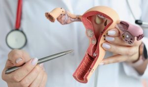 Foto: iStock/Ivan-balvan