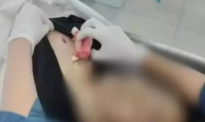 Korban Dijahit Setelah Diserang Geng Motor