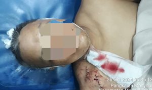 korban ketika dirumah sakit dalam kondisi meninggal dunia.(Istimewa)