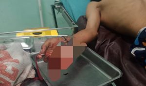 korban perampokan di Deli Serdang.(Istimewa).