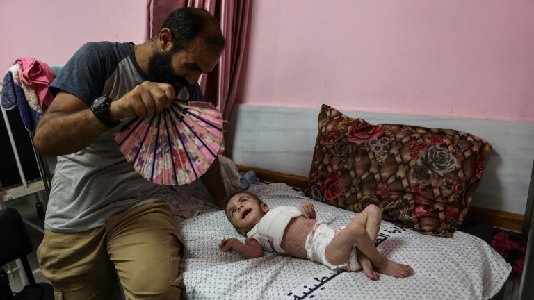 Anak-anak Gaza diserang penyakit kulit, BP/MC