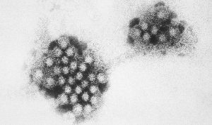Mengenal Norovirus: Penyebab, Gejala, dan Cara Pencegahannya