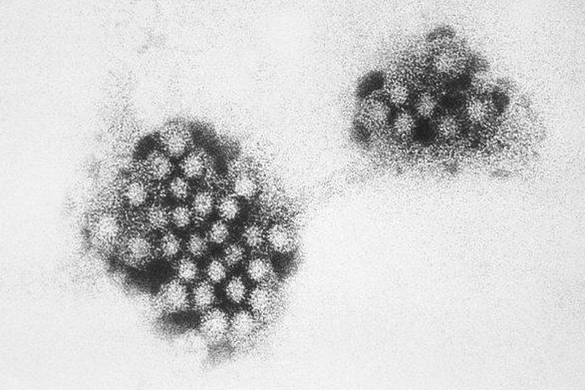 Mengenal Norovirus: Penyebab, Gejala, dan Cara Pencegahannya