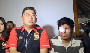 Alvin Lim Laporkan Selebgram Pratiwi Noviyanthi ke Bareskrim Polri