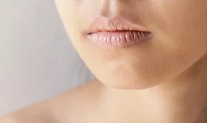 Penyebab Bibir Gatal dan Cara Mengatasinya