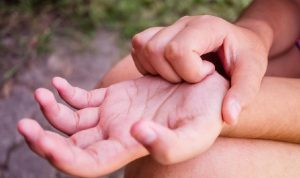 Telapak Tangan Gatal Bisa Jadi Tanda Gangguan Kesehatan, Kenali Penyebab dan Cara Mengatasinya