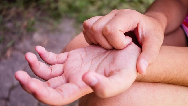 Telapak Tangan Gatal Bisa Jadi Tanda Gangguan Kesehatan, Kenali Penyebab dan Cara Mengatasinya