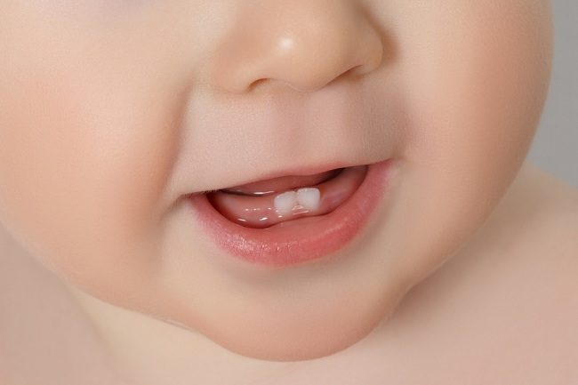 Bayi Baru Lahir Punya Gigi, Apa Penyebabnya dan Apa yang Harus Dilakukan?