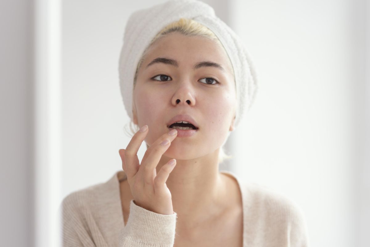 Ilustrasi kenapa bibir kering walaupun sudah minum banyak air