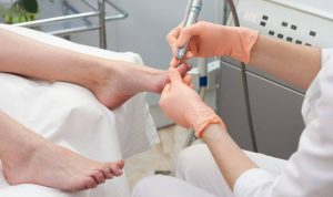 Cara Ampuh Atasi Cantengan Kaki Agar Tidak Infeksi