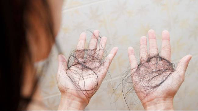 Ciri-Ciri Rambut Rontok karena Kanker yang Harus Diketahui