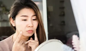 Penyebab dan Cara Mengatasi Moon Face yang Bikin Wajah Bengkak