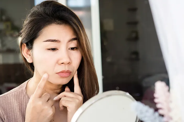 Penyebab dan Cara Mengatasi Moon Face yang Bikin Wajah Bengkak