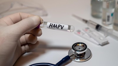 Protokol Kesehatan Penting untuk Cegah Penularan Human Metapneumovirus (HMPV)