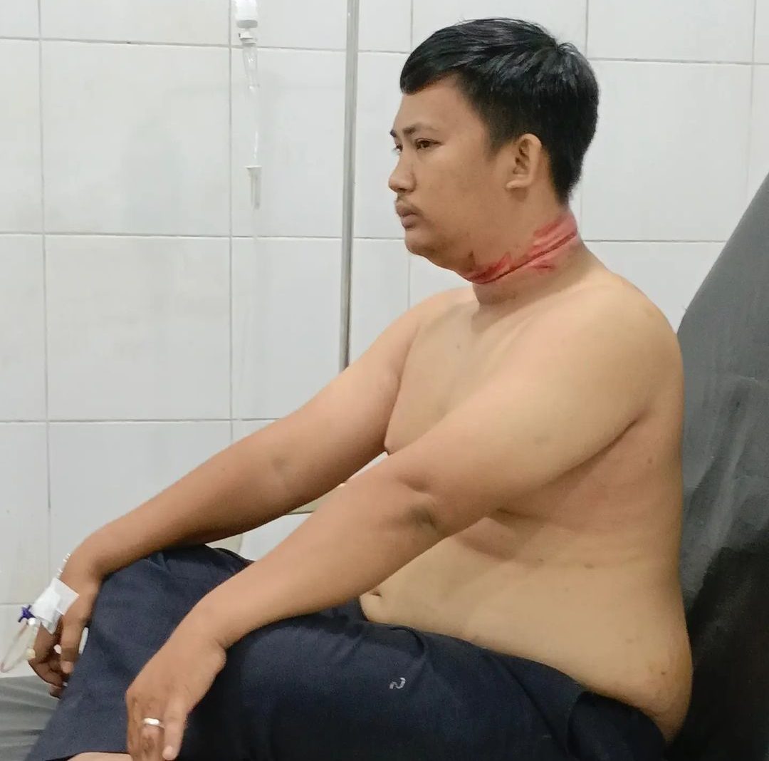 korban dengan luka di leher.(Istimewa).
