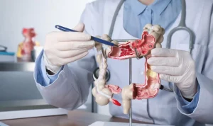 Kanker Usus Besar: Gejala, Penyebab, Diagnosis, dan Pengobatan yang Wajib Diketahui
