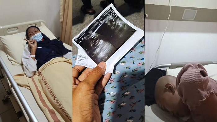 Kisah wanita Purwakarta yang terkena kanker serviks di usia 28
