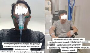 Viral pria meninggal usai mengalami sakit gigi.