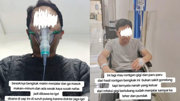 Viral pria meninggal usai mengalami sakit gigi.