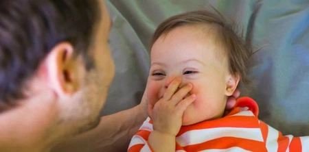 Penyebab Ibu Mengandung Bayi Down Syndrome, Faktor Risiko yang Perlu Diketahui