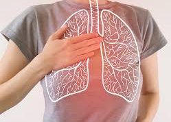 Pneumonia, Gejala, Penyebab, dan Pengobatan yang Perlu Anda Ketahui