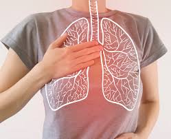 Pneumonia, Gejala, Penyebab, dan Pengobatan yang Perlu Anda Ketahui