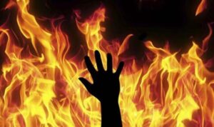 Pria Dibakar Anaknya di Medan, Alami Luka Bakar 80 Persen