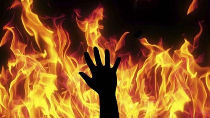 Pria Dibakar Anaknya di Medan, Alami Luka Bakar 80 Persen