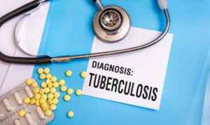 Sebelum Covid-19, tuberkulosis adalah salah satu penyakit menular yang paling mematikan.