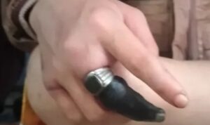 Pemadam Kebakaran (Damkar) Depok membantu melepaskan cincin salah satu warga