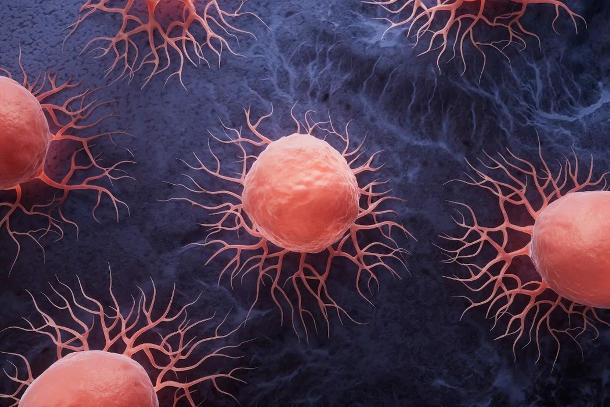 Ilustrasi sel kanker. (Kompas.com)