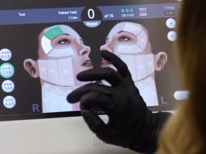 Ultherapy (detik.com)